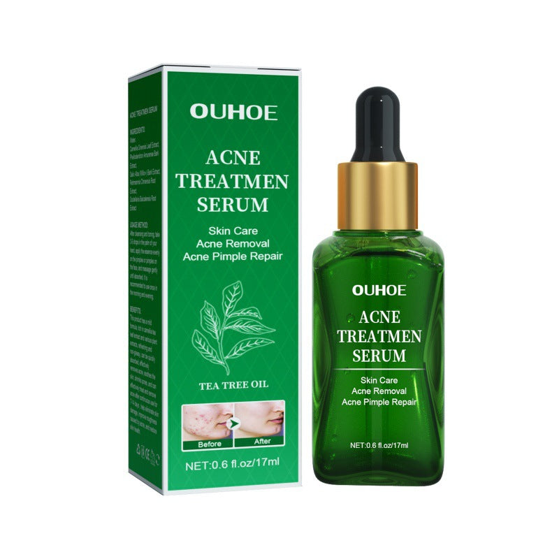 OUHOE Anti-Acne Facial Serum for Oil Control and Pores