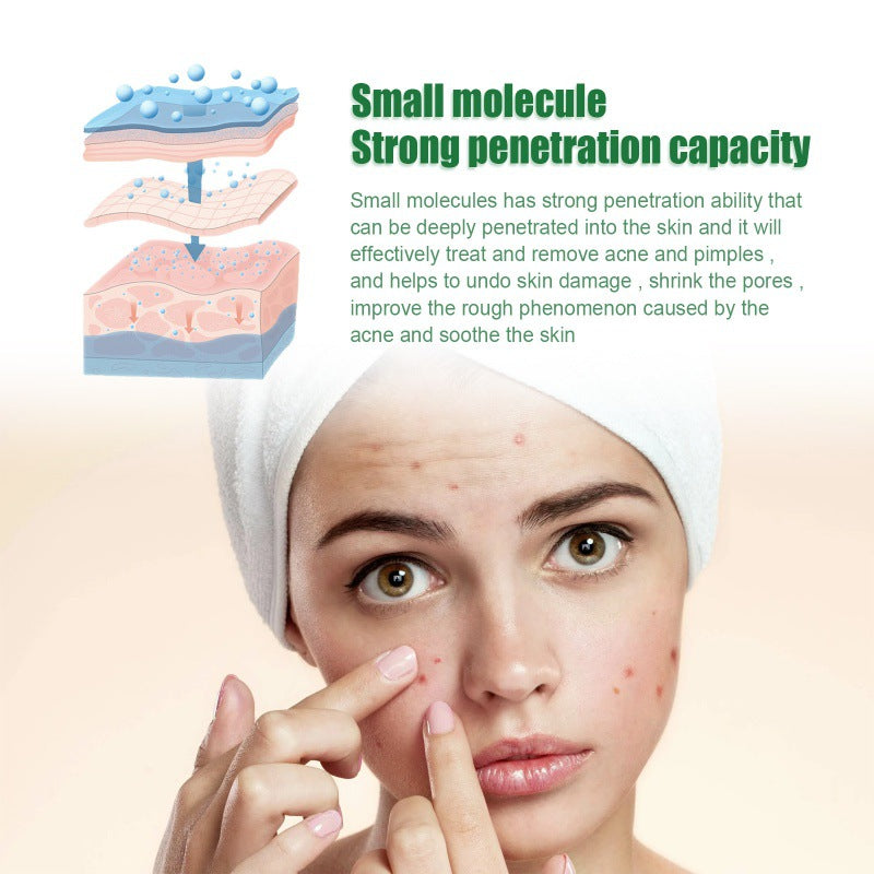 OUHOE Anti-Acne Facial Serum for Oil Control and Pores