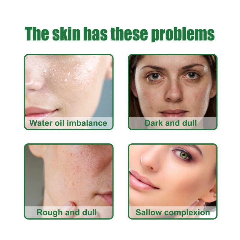 OUHOE Anti-Acne Facial Serum for Oil Control and Pores